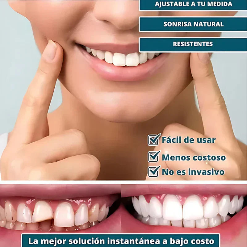 SmilePro 🦷 - Carillas Dentales  + ESTUCHE REGALO - ¡Últimas unidades!