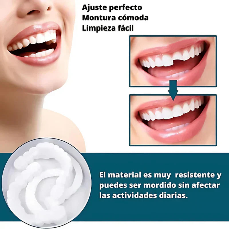 SmilePro 🦷 - Carillas Dentales  + ESTUCHE REGALO - ¡Últimas unidades!