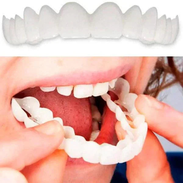 SmilePro 🦷 - Carillas Dentales  + ESTUCHE REGALO - ¡Últimas unidades!